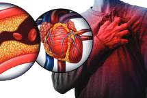 Image:Cardiovascular disease: Approved Doctors will be on the lookout for warning signs that a person may be at risk of suffering a sudden and disabling event. ENG1 restrictions may be issued. Image: Getty Images