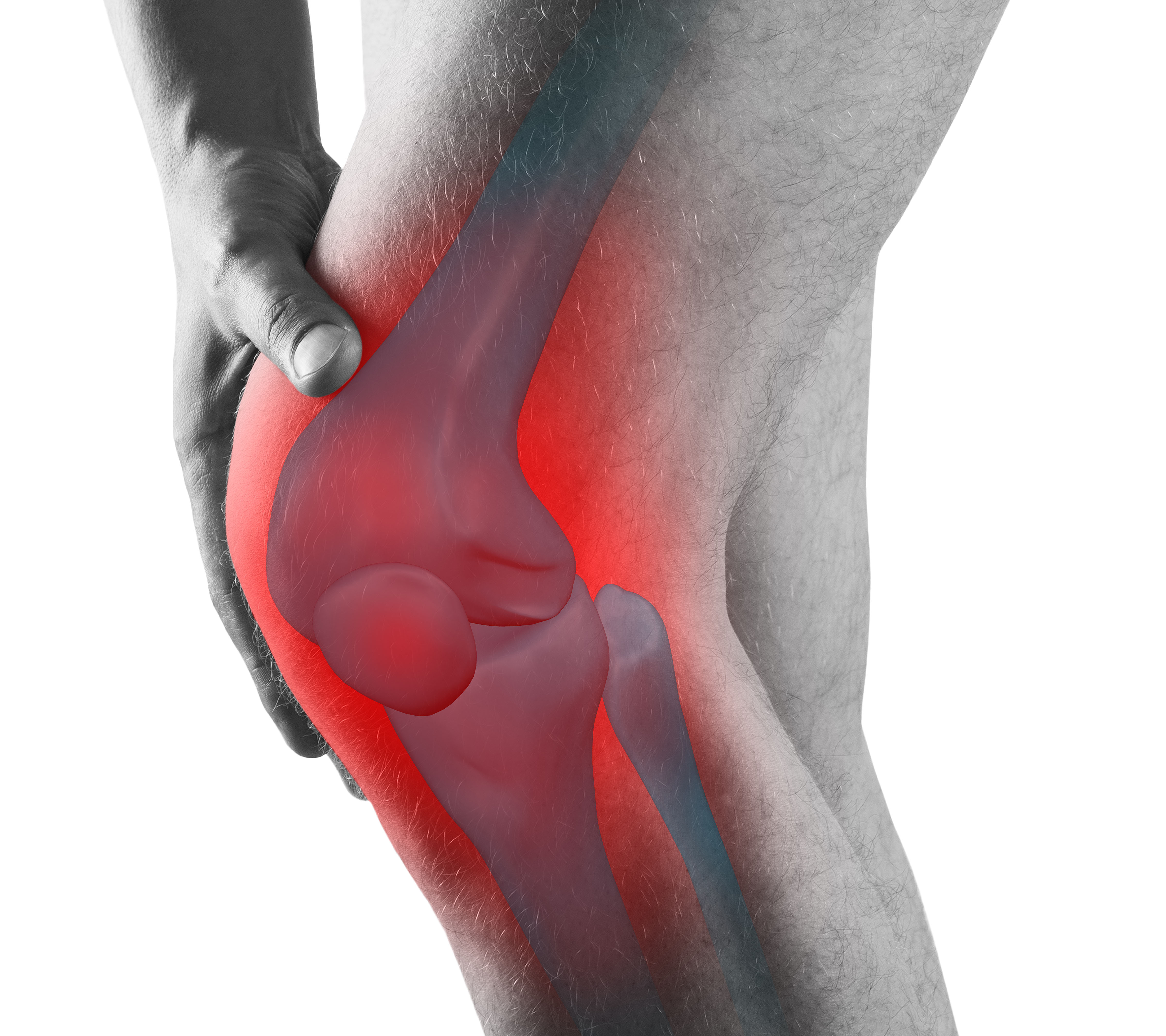 mca_feature_rheumatoid_arthritis_web_insert.jpg