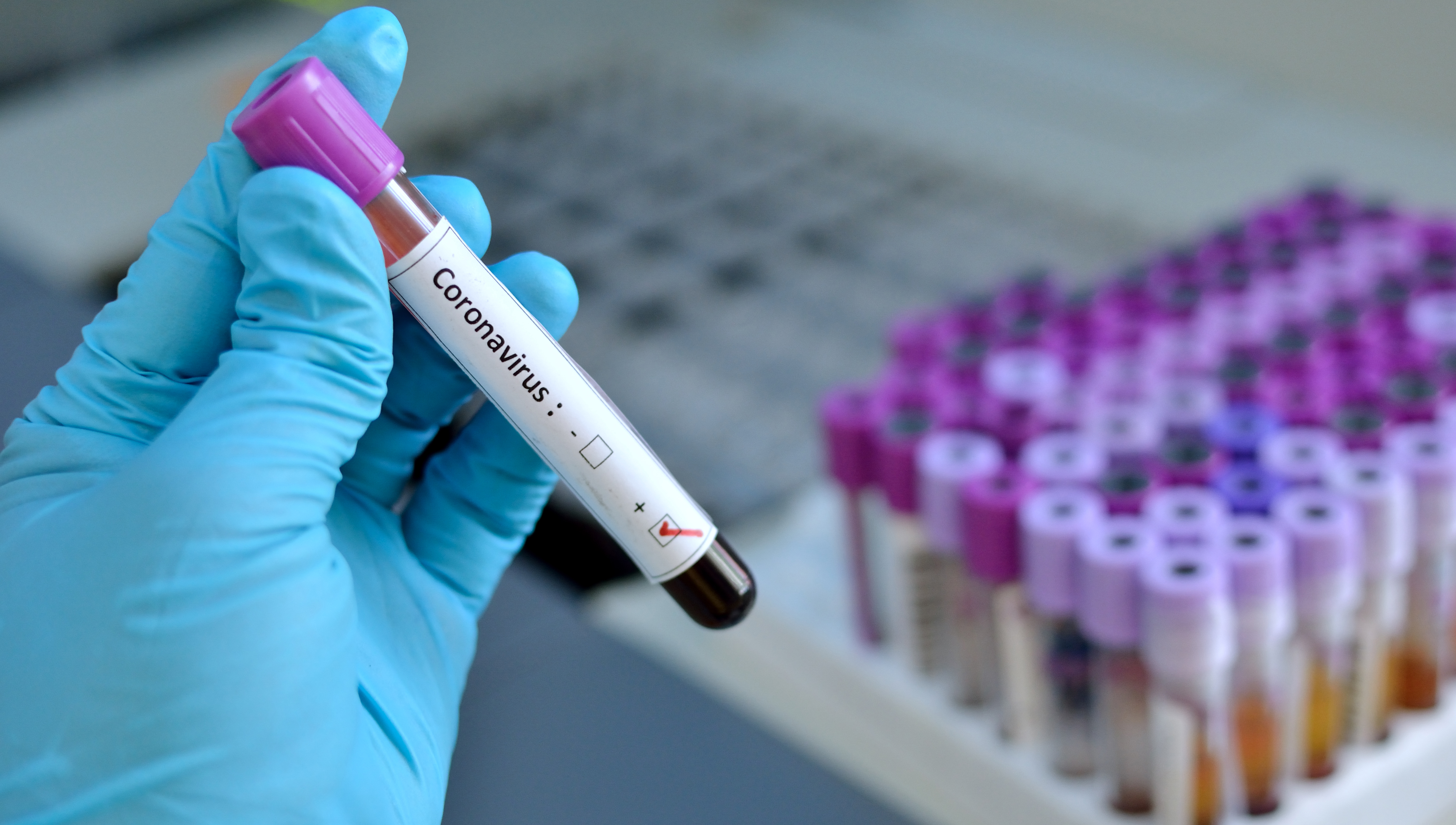 Image:The new Wuhan coronavirus is a member of the coronavirus family that has never been encountered before. Like other coronaviruses, such as severe acute respiratory syndrome (Sars) and Middle Eastern respiratory syndrome (Mers)  it has come from animals. Image: Getty Images